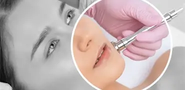 microdermabrasion in Bangalore